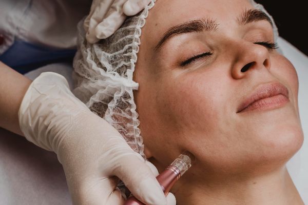 What Is Microdermabrasion and Should You Offer It at Your Salon?
